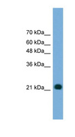 MYL4 Antibody - MYL4 antibody Western blot of Transfected 293T cell lysate. This image was taken for the unconjugated form of this product. Other forms have not been tested.
