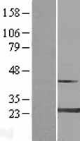 MYL4 Protein - Western validation with an anti-DDK antibody * L: Control HEK293 lysate R: Over-expression lysate