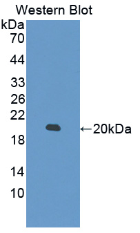 MYL6 Antibody - Western blot of MYL6 antibody.