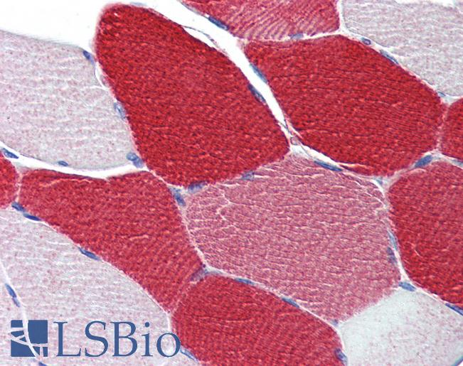 MYL6 Antibody - Anti-MYL6 antibody IHC of human skeletal muscle. Immunohistochemistry of formalin-fixed, paraffin-embedded tissue after heat-induced antigen retrieval. Antibody concentration 5 ug/ml.  This image was taken for the unconjugated form of this product. Other forms have not been tested.