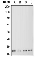 MYL6 Antibody - Western blot analysis of MYL6 expression in HeLa (A); K562 (B); SP2/0 (C); H9C2 (D) whole cell lysates.