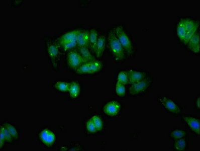 MYL6 Antibody - Immunofluorescent analysis of HepG2 cells using MYL6 Antibody at dilution of 1:100 and Alexa Fluor 488-congugated AffiniPure Goat Anti-Rabbit IgG(H+L)