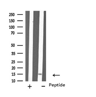 MYL6 Antibody - Western blot analysis of extracts of K562 cells using MYL6 antibody.