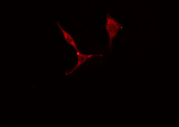 MYL6 Antibody - Staining HeLa cells by IF/ICC. The samples were fixed with PFA and permeabilized in 0.1% Triton X-100, then blocked in 10% serum for 45 min at 25°C. The primary antibody was diluted at 1:200 and incubated with the sample for 1 hour at 37°C. An Alexa Fluor 594 conjugated goat anti-rabbit IgG (H+L) antibody, diluted at 1/600, was used as secondary antibody.