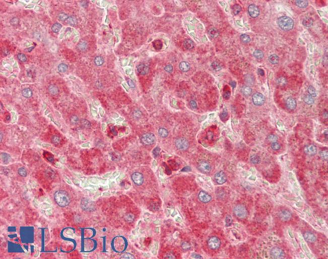 MYL6 Antibody - Human Liver: Formalin-Fixed, Paraffin-Embedded (FFPE).  This image was taken for the unconjugated form of this product. Other forms have not been tested.