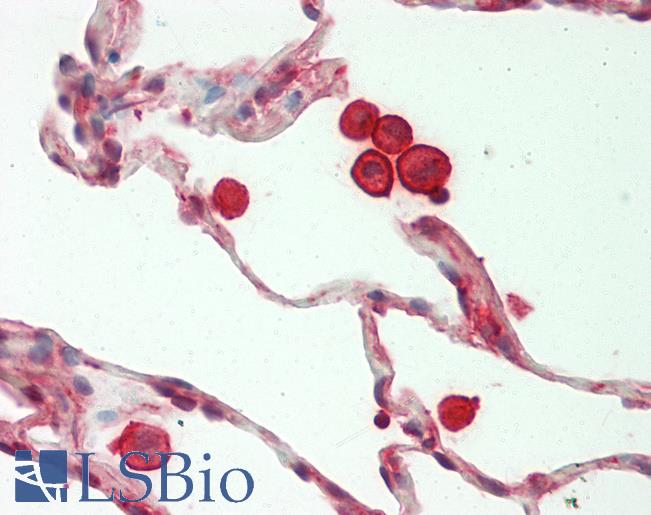 MYL6 Antibody - Human Lung: Formalin-Fixed, Paraffin-Embedded (FFPE).  This image was taken for the unconjugated form of this product. Other forms have not been tested.
