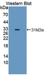 MYL6B Antibody - Western blot of MYL6B antibody.