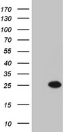 MYL6B Antibody - HEK293T cells were transfected with the pCMV6-ENTRY control. (Left lane) or pCMV6-ENTRY MYL6B. (Right lane) cDNA for 48 hrs and lysed