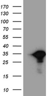 MYL6B Antibody - HEK293T cells were transfected with the pCMV6-ENTRY control. (Left lane) or pCMV6-ENTRY MYL6B. (Right lane) cDNA for 48 hrs and lysed. Equivalent amounts of cell lysates. (5 ug per lane) were separated by SDS-PAGE and immunoblotted with anti-MYL6B. (1:2000)