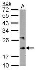MYL6B Antibody - Sample (30 ug of whole cell lysate) A: K562 12% SDS PAGE MYL6B antibody diluted at 1:10000