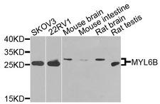 MYL6B Antibody - Western blot analysis of extracts of various cells.