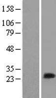 MYL6B Protein - Western validation with an anti-DDK antibody * L: Control HEK293 lysate R: Over-expression lysate