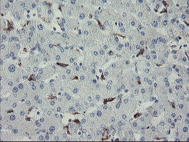 MYL7 Antibody - IHC of paraffin-embedded Human liver tissue using anti-MYL7 mouse monoclonal antibody.