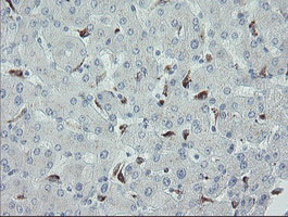 MYL7 Antibody - IHC of paraffin-embedded Human liver tissue using anti-MYL7 mouse monoclonal antibody.