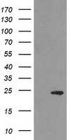 MYL7 Antibody - HEK293T cells were transfected with the pCMV6-ENTRY control (Left lane) or pCMV6-ENTRY MYL7 (Right lane) cDNA for 48 hrs and lysed. Equivalent amounts of cell lysates (5 ug per lane) were separated by SDS-PAGE and immunoblotted with anti-MYL7.