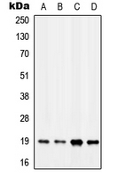 MYL7 Antibody - Western blot analysis of MYL7 expression in MCF7 (A); K562 (B); SP2/0 (C); H9C2 (D) whole cell lysates.