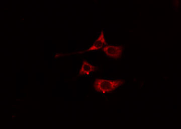 MYL7 Antibody - Staining HeLa cells by IF/ICC. The samples were fixed with PFA and permeabilized in 0.1% Triton X-100, then blocked in 10% serum for 45 min at 25°C. The primary antibody was diluted at 1:200 and incubated with the sample for 1 hour at 37°C. An Alexa Fluor 594 conjugated goat anti-rabbit IgG (H+L) antibody, diluted at 1/600, was used as secondary antibody.