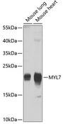 MYL7 Antibody - Western blot analysis of extracts of various cell lines using MYL7 Polyclonal Antibody at dilution of 1:1000.