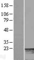 MYL7 Protein - Western validation with an anti-DDK antibody * L: Control HEK293 lysate R: Over-expression lysate