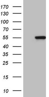 MYLIP / IDOL Antibody - HEK293T cells were transfected with the pCMV6-ENTRY control. (Left lane) or pCMV6-ENTRY MYLIP. (Right lane) cDNA for 48 hrs and lysed. Equivalent amounts of cell lysates. (5 ug per lane) were separated by SDS-PAGE and immunoblotted with anti-MYLIP. (1:2000)