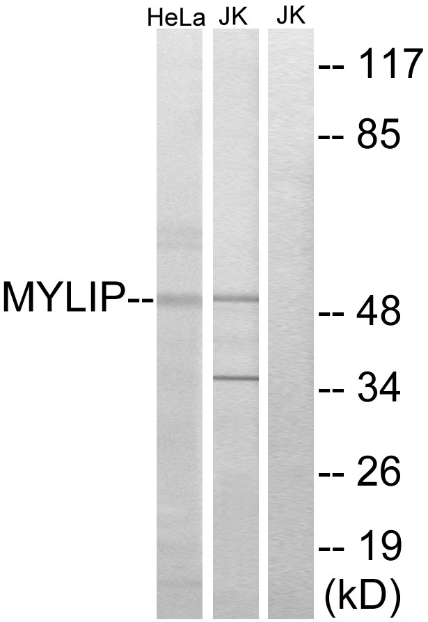 MYLIP / IDOL Antibody - Western blot analysis of lysates from HeLa and Jurkat cells, using MYLIP Antibody. The lane on the right is blocked with the synthesized peptide.