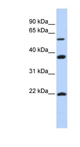 MYLIP / IDOL Antibody - MYLIP antibody Western blot of SK-MEL-2 cell lysate. This image was taken for the unconjugated form of this product. Other forms have not been tested.