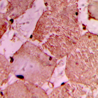 MYLIP / IDOL Antibody - Immunohistochemical analysis of IDOL staining in human heart formalin fixed paraffin embedded tissue section. The section was pre-treated using heat mediated antigen retrieval with sodium citrate buffer (pH 6.0). The section was then incubated with the antibody at room temperature and detected using an HRP conjugated compact polymer system. DAB was used as the chromogen. The section was then counterstained with hematoxylin and mounted with DPX.