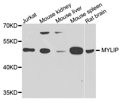 MYLIP / IDOL Antibody - Western blot analysis of extract of various cells.