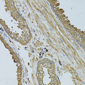 MYLIP / IDOL Antibody - Immunohistochemistry of paraffin-embedded human prostate tissue.