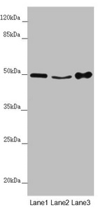 MYLIP / IDOL Antibody - Western blot All Lanes:MYLIP antibody at 4.06 ug/ml Lane 1: Mouse brain tissue Lane 2: Mouse liver tissue Lane 3: Mouse spleen tissue Secondary Goat polyclonal to rabbit IgG at 1/10000 dilution Predicted band size: 50,15 kDa Observed band size: 50 kDa