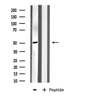 MYLIP / IDOL Antibody - Western blot analysis of extracts of HeLa cells using MYLIP antibody.