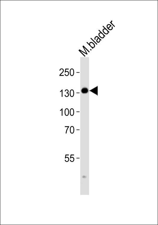 MYLK Antibody - Western blot of lysate from mouse bladder tissue lysate, using MLCKlong Antibody (M1). Antibody was diluted at 1:1000. A goat anti-rabbit IgG H&L (HRP) at 1:10000 dilution was used as the secondary antibody. Lysate at 35ug.