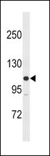 MYLK Antibody - MLCK Antibody (M1) western blot of SK-BR-3 cell line lysates (35 ug/lane). The MLCK antibody detected the MLCK protein (arrow).