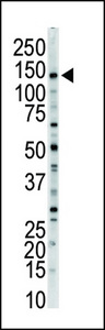 MYLK Antibody - Western blot of anti-MLCK-long antibody in mouse brain tissue lysate. MLCK-long (Arrow) was detected using purified antibody. Secondary HRP-anti-rabbit was used for signal visualization with chemiluminescence.