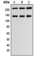 MYLK Antibody - Western blot analysis of MLCK1 expression in HeLa (A); SP2/0 (B); H9C2 (C) whole cell lysates.