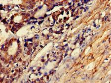 MYLK Antibody - Immunohistochemistry of paraffin-embedded human smooth muscle tissue at dilution of 1:100