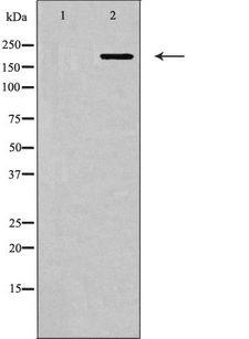 MYLK Antibody - Western blot analysis of MYLK expression in HepG2 cells. The lane on the left is treated with the antigen-specific peptide.