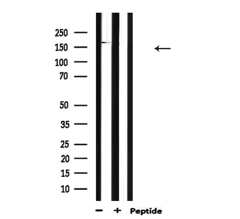 MYLK Antibody - Western blot analysis of extracts of mouse muscle using MYLK antibody.