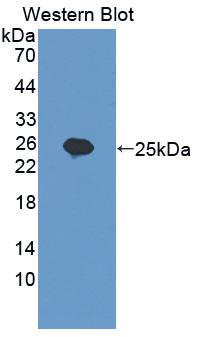 MYLK2 Antibody - Western blot of MYLK2 antibody.