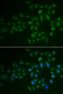 MYLK3 Antibody - Immunofluorescence analysis of U2OS cells.