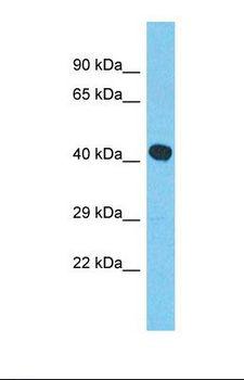 MYLK4 Antibody - Western blot of Human RPMI-8226. MYLK4 antibody dilution 1.0 ug/ml.  This image was taken for the unconjugated form of this product. Other forms have not been tested.