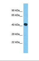 MYLK4 Antibody - Western blot of Human RPMI-8226. MYLK4 antibody dilution 1.0 ug/ml.  This image was taken for the unconjugated form of this product. Other forms have not been tested.