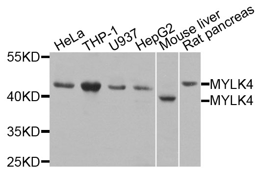 MYLK4 Antibody - Western blot analysis of extracts of various cell lines, using MYLK4 antibody at 1:1000 dilution. The secondary antibody used was an HRP Goat Anti-Rabbit IgG (H+L) at 1:10000 dilution. Lysates were loaded 25ug per lane and 3% nonfat dry milk in TBST was used for blocking. An ECL Kit was used for detection and the exposure time was 90s.