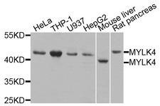 MYLK4 Antibody - Western blot analysis of extracts of various cell lines, using MYLK4 antibody at 1:1000 dilution. The secondary antibody used was an HRP Goat Anti-Rabbit IgG (H+L) at 1:10000 dilution. Lysates were loaded 25ug per lane and 3% nonfat dry milk in TBST was used for blocking. An ECL Kit was used for detection and the exposure time was 90s.