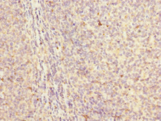 MYLK4 Antibody - Immunohistochemistry of paraffin-embedded human tonsil tissue at dilution 1:100