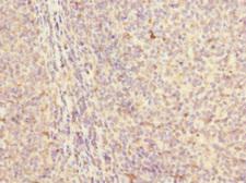 MYLK4 Antibody - Immunohistochemistry of paraffin-embedded human tonsil tissue at dilution 1:100