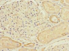 MYLK4 Antibody - Immunohistochemistry of paraffin-embedded human kidney tissue at dilution 1:100