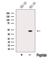 MYLK4 Antibody - Western blot analysis of extracts of HEK293 cells using MYLK4 antibody. The lane on the left was treated with blocking peptide.