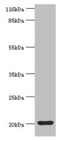 MYLPF Antibody - Western blot All lanes: MYLPF antibody at 2µg/ml + Mouse skeletal muscle tissue Secondary Goat polyclonal to rabbit IgG at 1/10000 dilution Predicted band size: 20 kDa Observed band size: 20 kDa