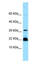 MYLPF Antibody - MYLPF antibody Western Blot of Jurkat.  This image was taken for the unconjugated form of this product. Other forms have not been tested.